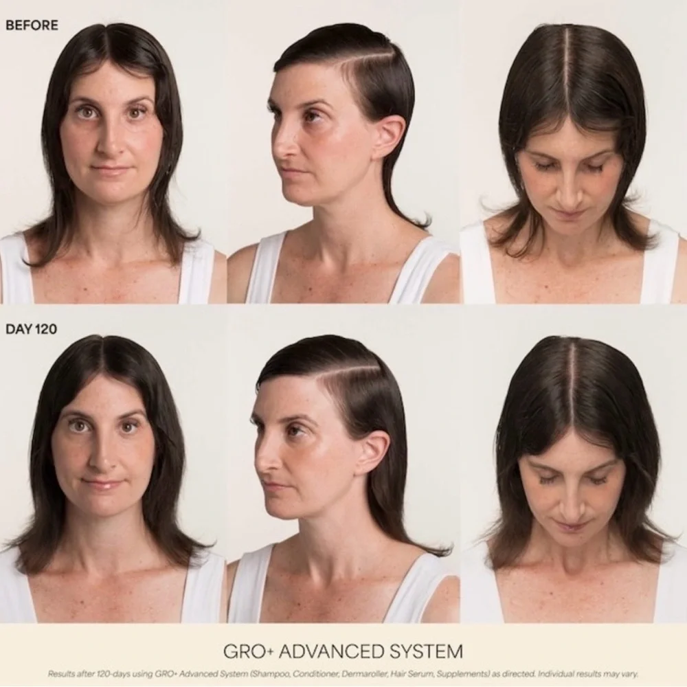 🎸Vegamour🎸🔥NWT🔥GRO+ Advanced Hair Serum for Severe Signs of Thinning-1 Fl oz.